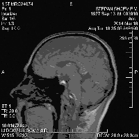 МРТ головного мозга (427.38КиБ)